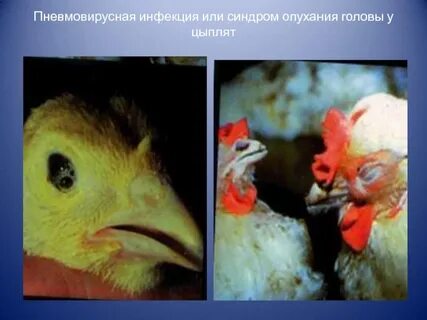 Инфекция куру