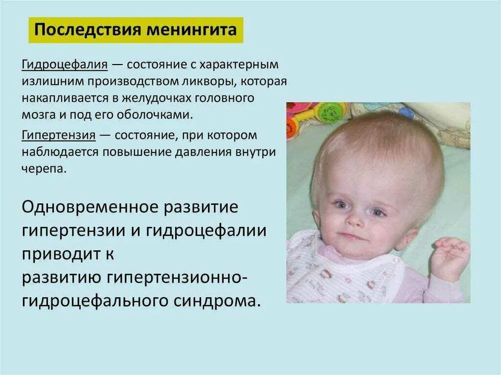 Три случая заболевания корью выявили в этом году в Красноярском крае Здоровье Се