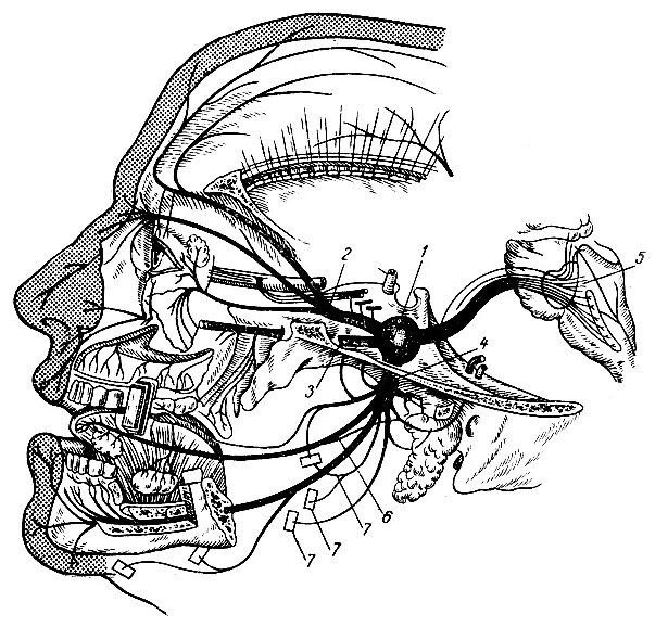 Черепные нервные узлы. Схема 5 пары черепных нервов. Тройничный черепно мозговой нерв. Черепные нервы тройничный нерв. Тройничный нерв 1 ветвь глазной.