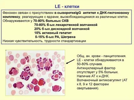 Диагностики феномена