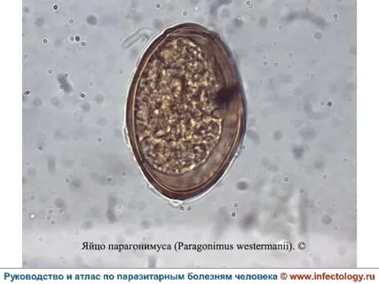 Лямблии описторхи
