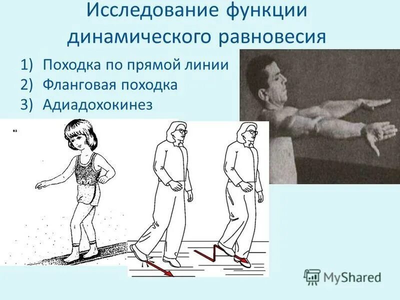 исследование походки. вестибулярная атаксия проба ромберга. вестибулярные пробы. исследования походки человека. вестибулярная и мозжечковая атаксия.