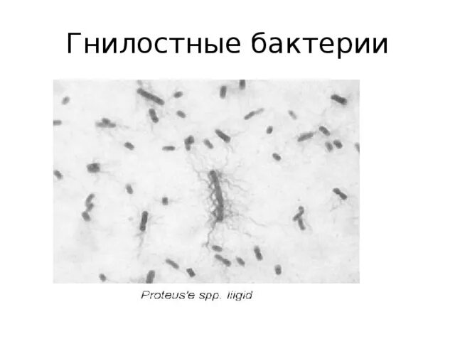 Признаки гнилостных бактерий. Аммонифицирующие бактерии под микроскопо. Бактерии гниения под микроскопом. Гнилостные бактерии. Гнилостные бактерии под микроскопом.