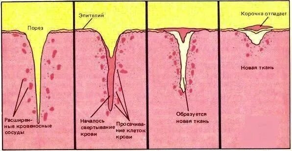 Через сколько заживает рана. Процесс заживления РАН схема. Процесс заживления раны.