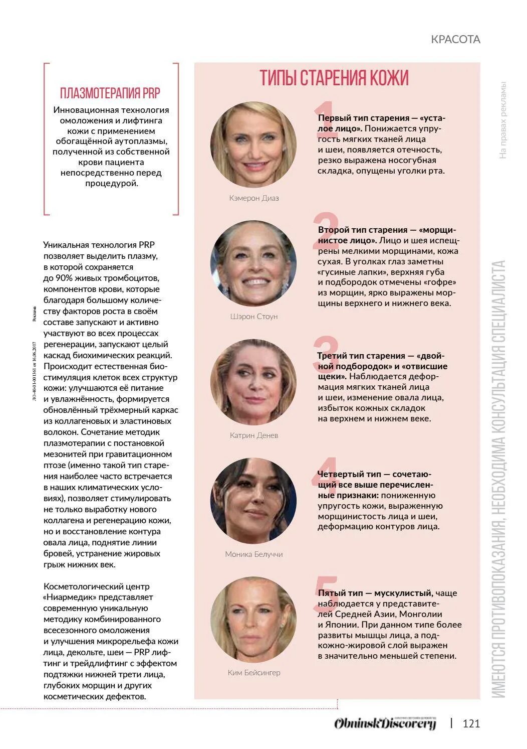 Мускульный тип старения кожи. Усталый тип старения лица. Как узнать свой тип старения лица. Типаж кэмерон диаз. Мышечно отечный тип старения.