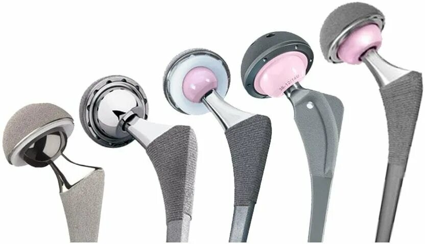 эндопротез зиммер. тазобедренные эндопротез фирмы зиммер. титановые эндопротезы. эндопротезирование тазобедренного сустава зиммер. тазобедренный эндопротез зиммер.