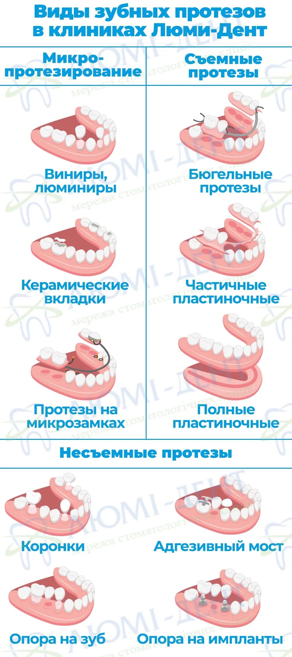 Зубы протезирование виды отзывы. Виды съемных протезов классификация. варианты протезирования зубов. формы зубов для протезирования.