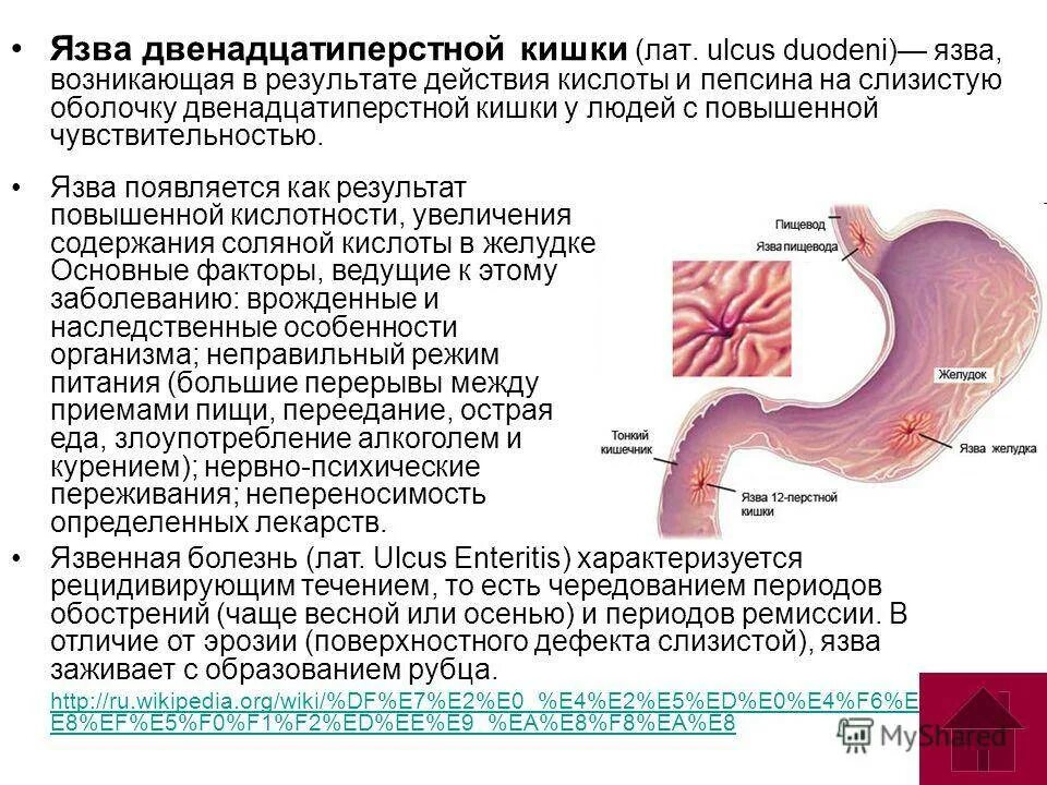 Язвенная болезнь желудка и 12 перстной. Язвенная болезнь 12 перстной кишки кишки. Синдромы язвенной болезни 12 перстной кишки. Осложнения желудка 12 перстной кишки