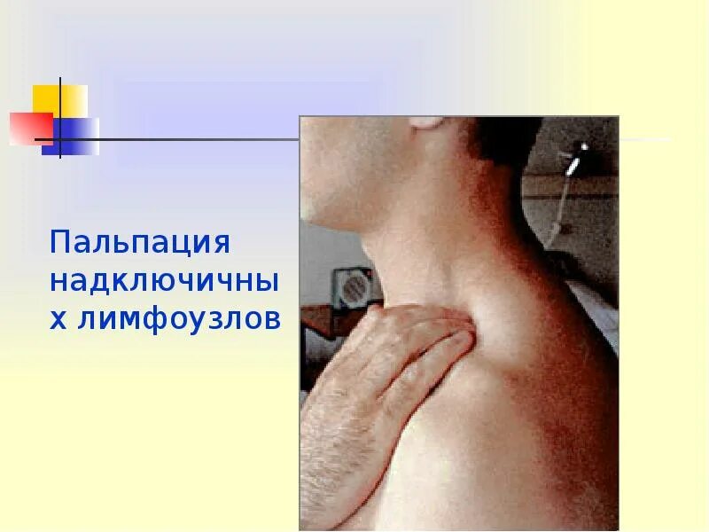 Поднижнечелюстные лимфоузлы воспаление. Опухоль затылочной лимфоузлы. Пальпация надключичных и подключичных лимфоузлов. Лимфаденит периферических лимфоузлов. Нормальные и увеличенные лимфоузлы.