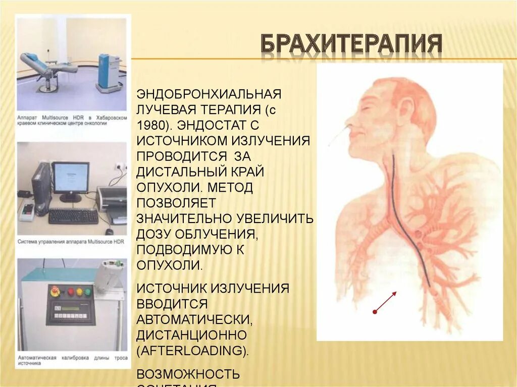 Брахитерапия лучевая терапия. Внутреннее облучение брахитерапия. Брахитерапия рака отзывы