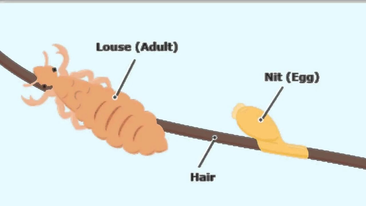 Переносчики вшивого сыпного тифа. Вши перевод. Вши являются переносчиками возбудителей. Pediculus humanus capitis строение. Вши перевод.