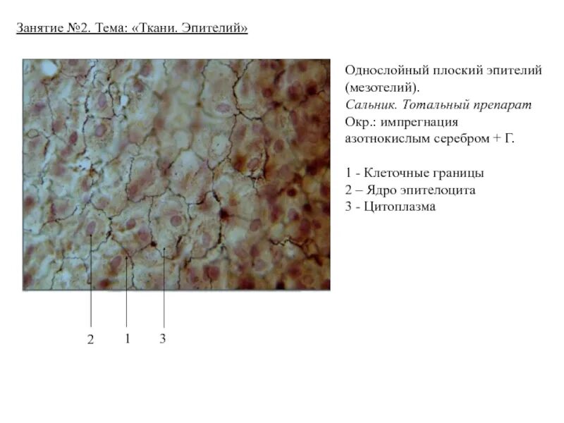 Однослойный мезотелий. Однослойный плоский эпителий мезотелий сальника препарат. Однослойный плоский эпителий импрегнация серебром. Однослойный плоский эпителий мезотелий брюшины Тотальный препарат. Препарат мезотелий брюшины.