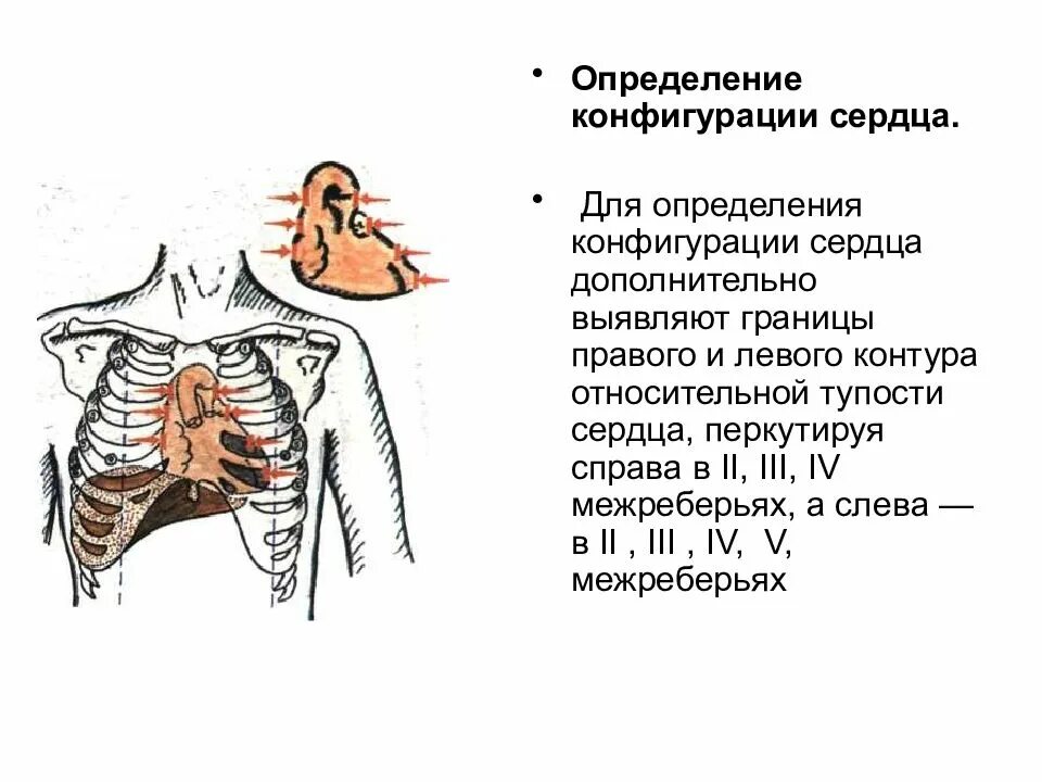 Относительная перкуссия сердца норма. Перкуссия сосудистого пучка сердца в норме границы. Границы относительной тупости сердца перкуссия. Перкуссия левой границы сердца.