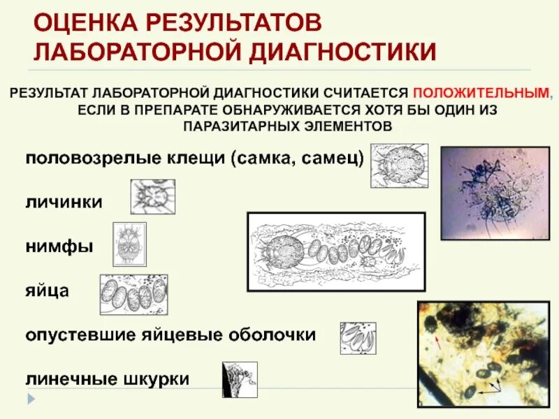 Лабораторные методы для обнаружения чесоточного клеща. Методы терапии при чесотке. Дифференциальный диагноз чесотки. Лабораторная диагностика чесотки. Методы лабораторной диагностики чесотки.