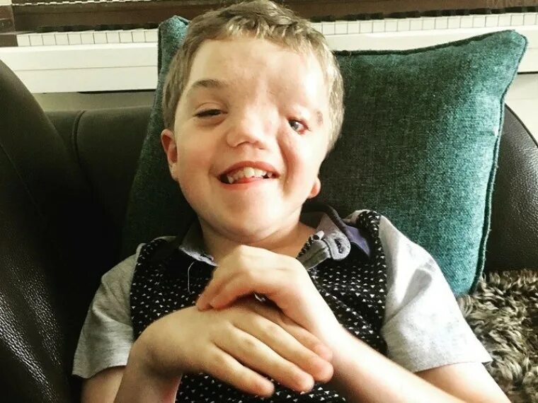 Дауны и аутисты. Мальчик даун. Дцп и синдром дауна. Дети с болезнью дауна. Дети с аутизмом и дцп.