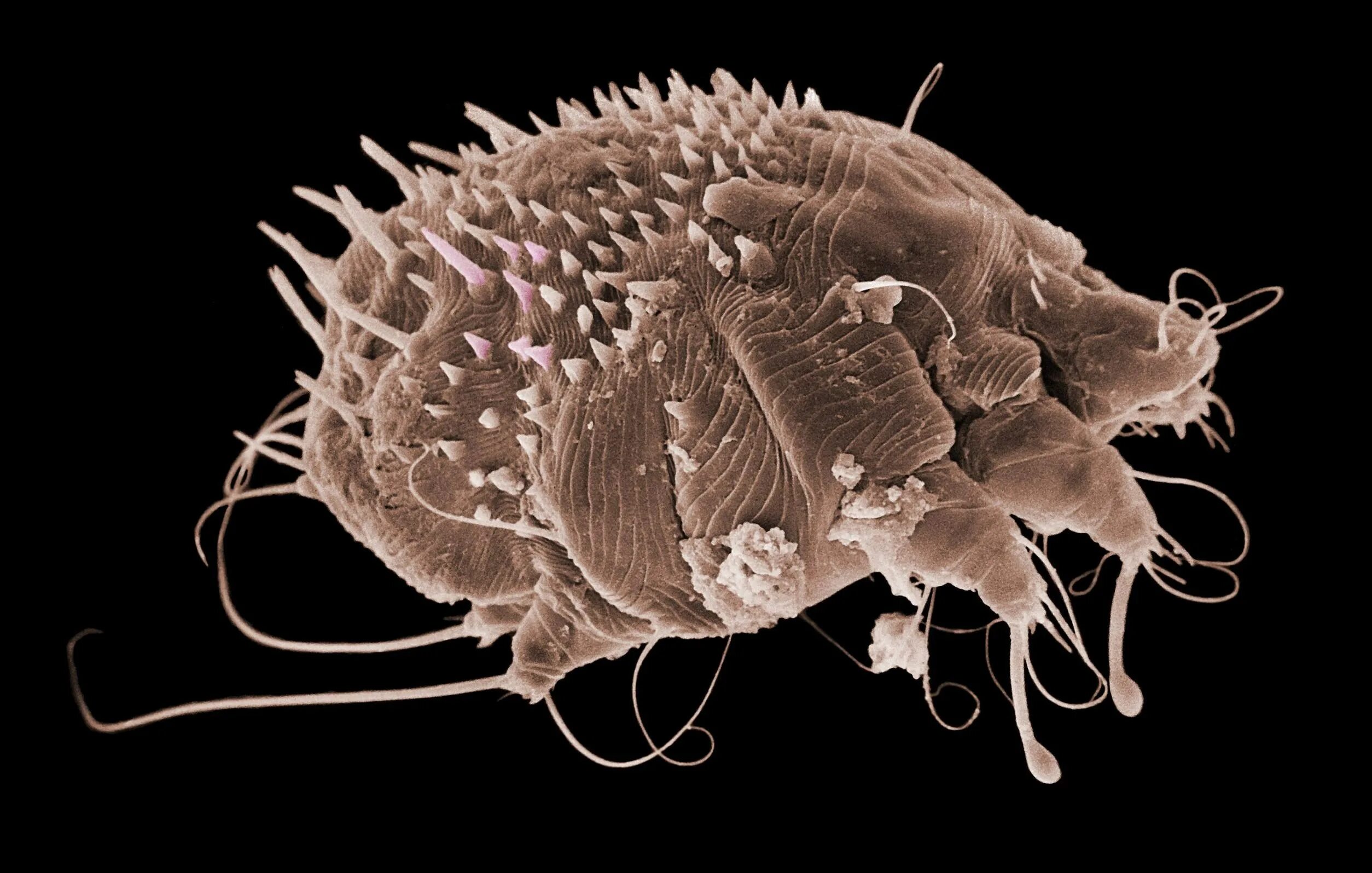 Бактерии клещей. Чесоточный зудень микроскоп.