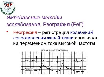 Метод реографии основан на