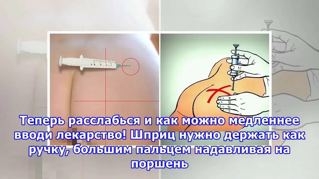 Ставить уколы дома. Как правильно сделать укол. Укол в ягодицу схема. Схема внутримышечного укола. Как правильно делать укол.