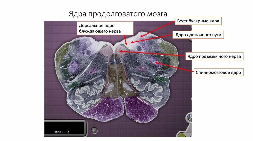 Нервные продолговатого мозга. Продолговатый мозг гистологический срез. Дорзальное ядро блуждающего нерва. Ядра продолговатого мозга. Дорсальное ядро ядро блуждающего нерва.