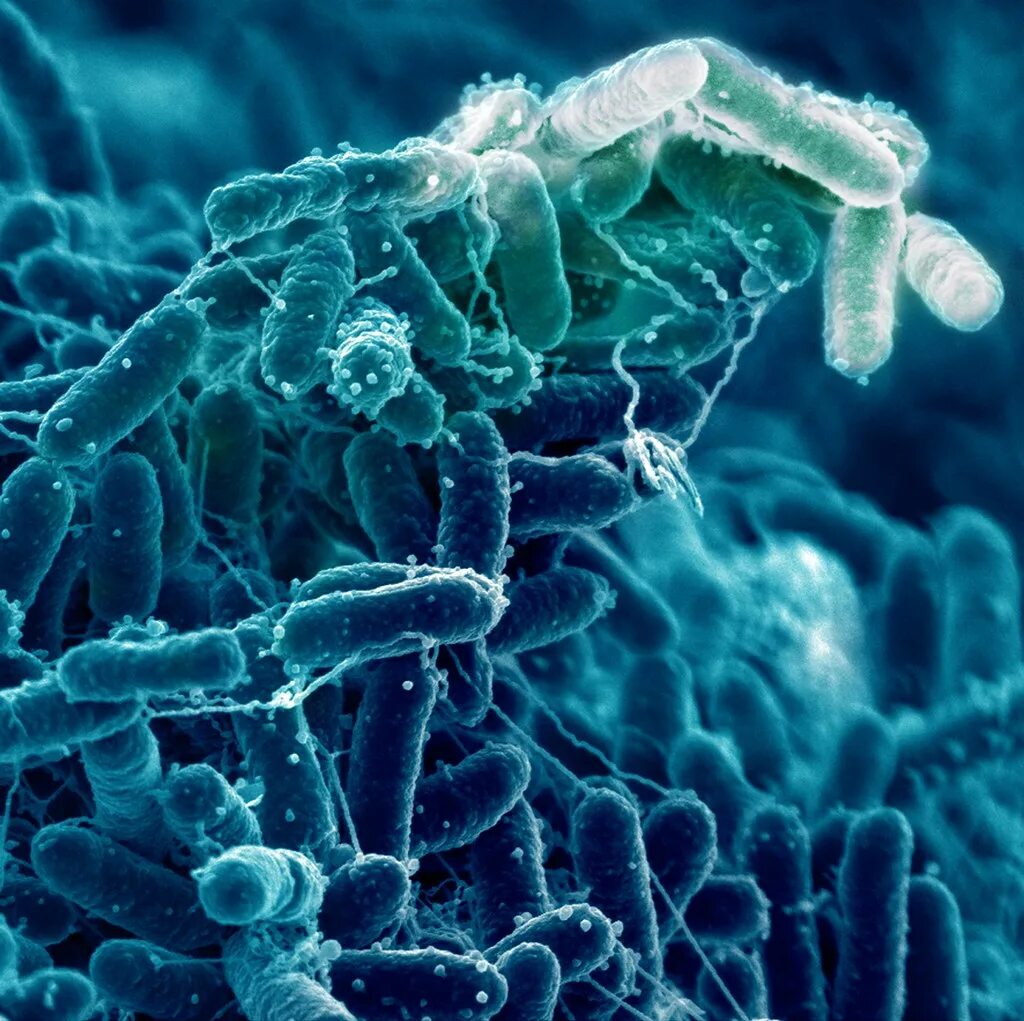 Бифидо и лактобактерии под микроскопом. Бифидобактерии микробиология. Бифидобактерии ВВ-12. Бифидобактерии дисбактериоз.
