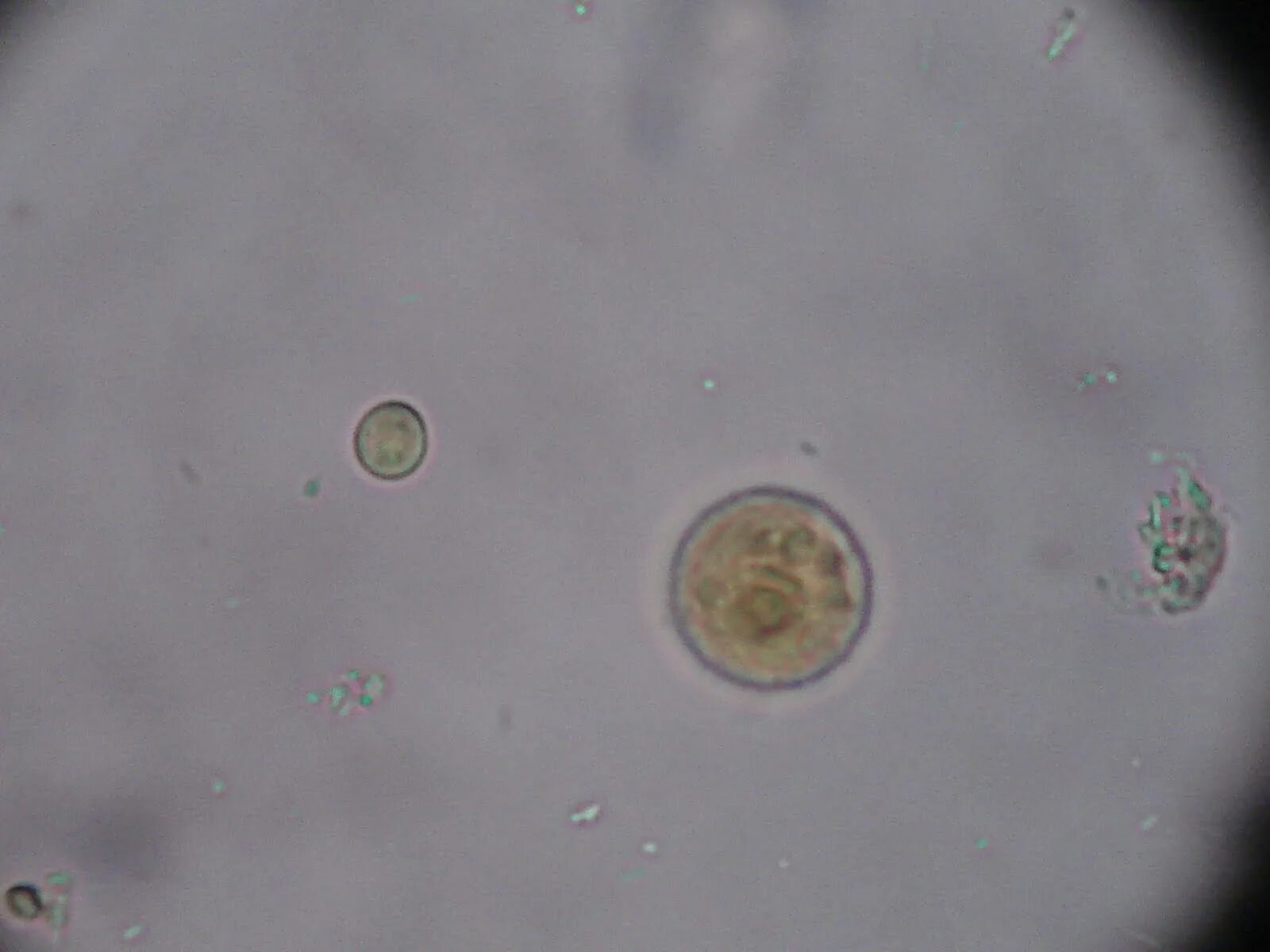 Цисты в воде. Цисты entamoeba. endolimax nana в кале.