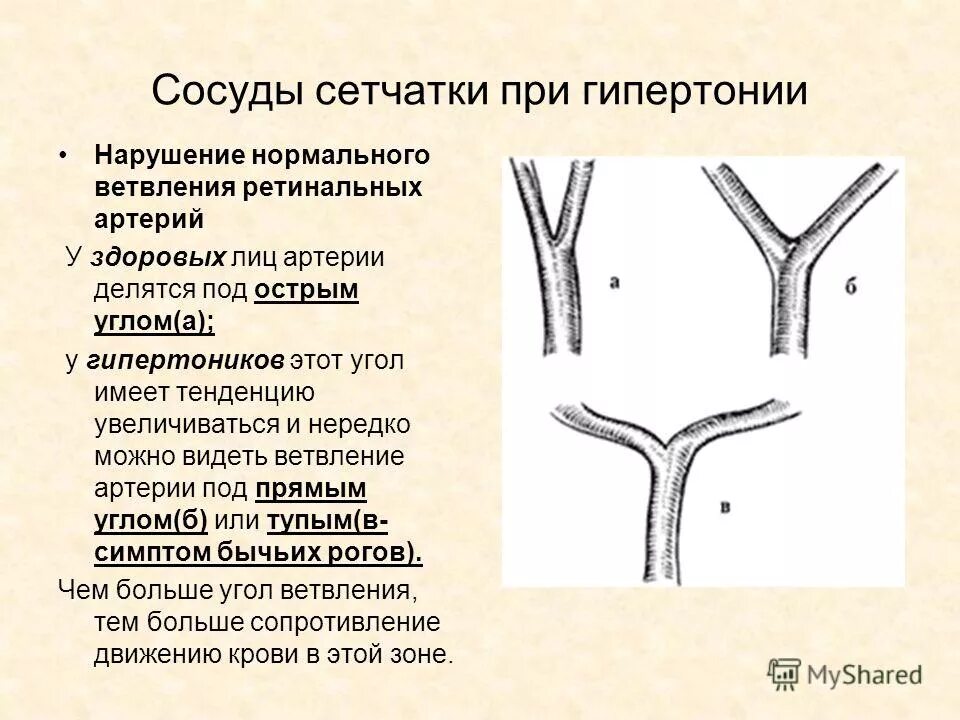 типы ветвления кровеносных сосудов. закономерности расположения сосудов. типы ветвления кровеносных сосудов. строение артерий вен и капилляров анатомия. закономерности хода и ветвления сосудов.
