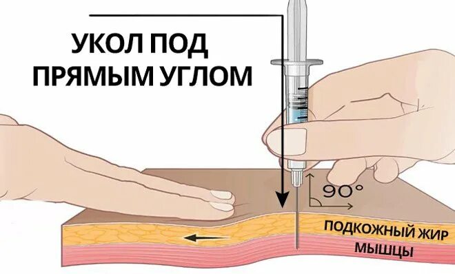 Колоть уколы места