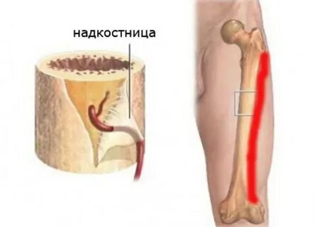 Надкостница лечение