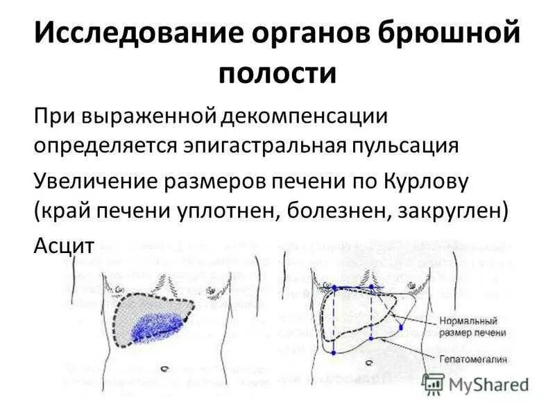 Нижняя граница печени. Топографическая перкуссия печени по курлову. Перкуссия печени алгоритм. Методика определения размеров печени по курлову. Перкуссия печени по курлову алгоритм.