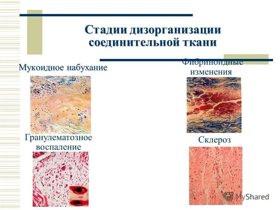 Болезни группы б