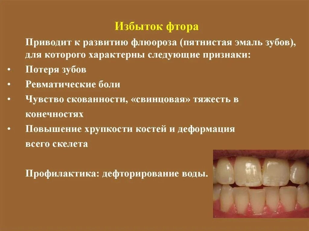 Признаки стороны зуба. Системная гипоплазия эмали зубов. Системная гипоплазия эмали зубов у детей. Гипоплазия эмали гипоплазия флюороз.