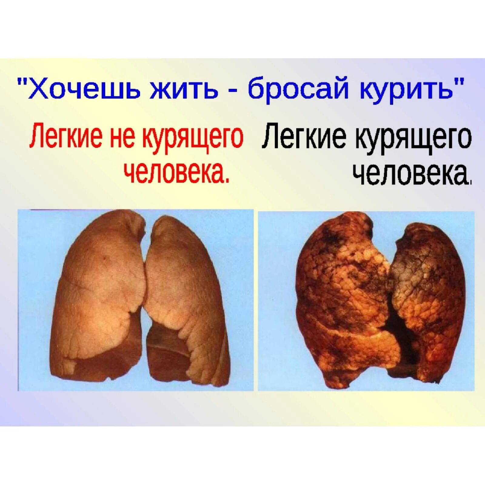 Организм после сигарет. Легкие курильщика и здорового человека. Легкие человека курильщика.