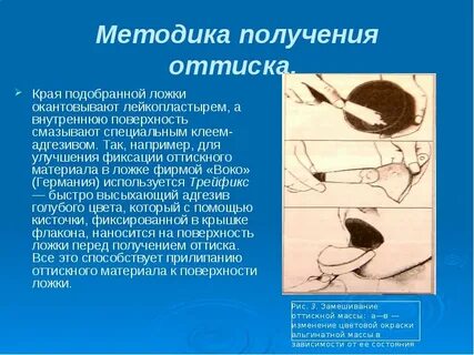Методы получения оттиска