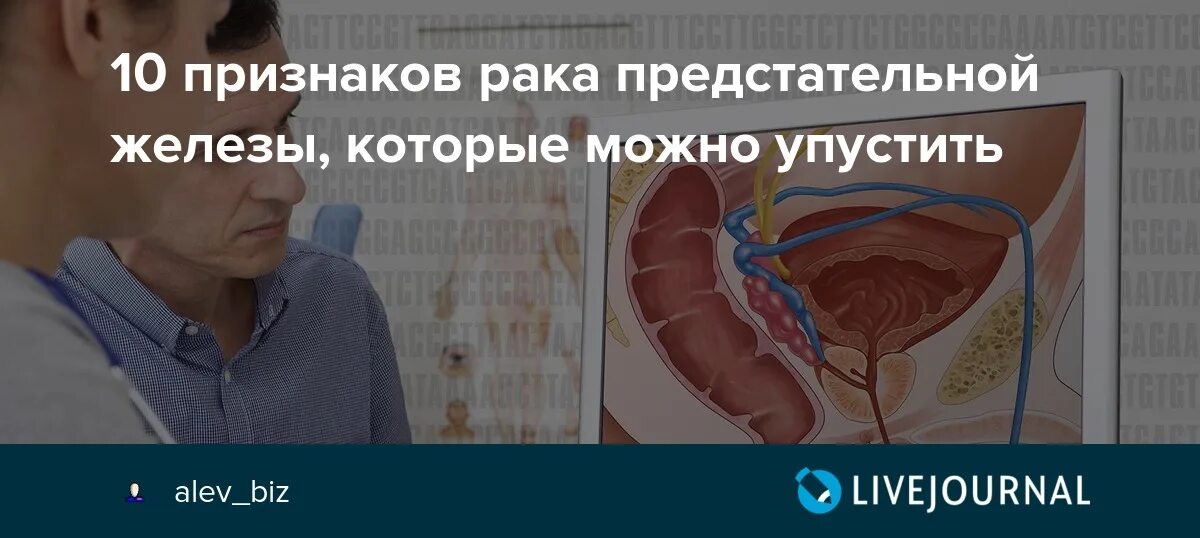 Опухоль простаты у мужчин. Онкология предстательной железы. Онкология простаты симптомы. Рак предстательной цена