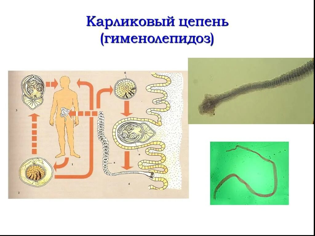 Карликовый цепень (Hymenolepis Nana). Карликовый цепень паразитология. Ленточные черви паразиты карликовый цепень. Карликовый цепень, возбудитель гименолепидоза. Карликовый цепень строение