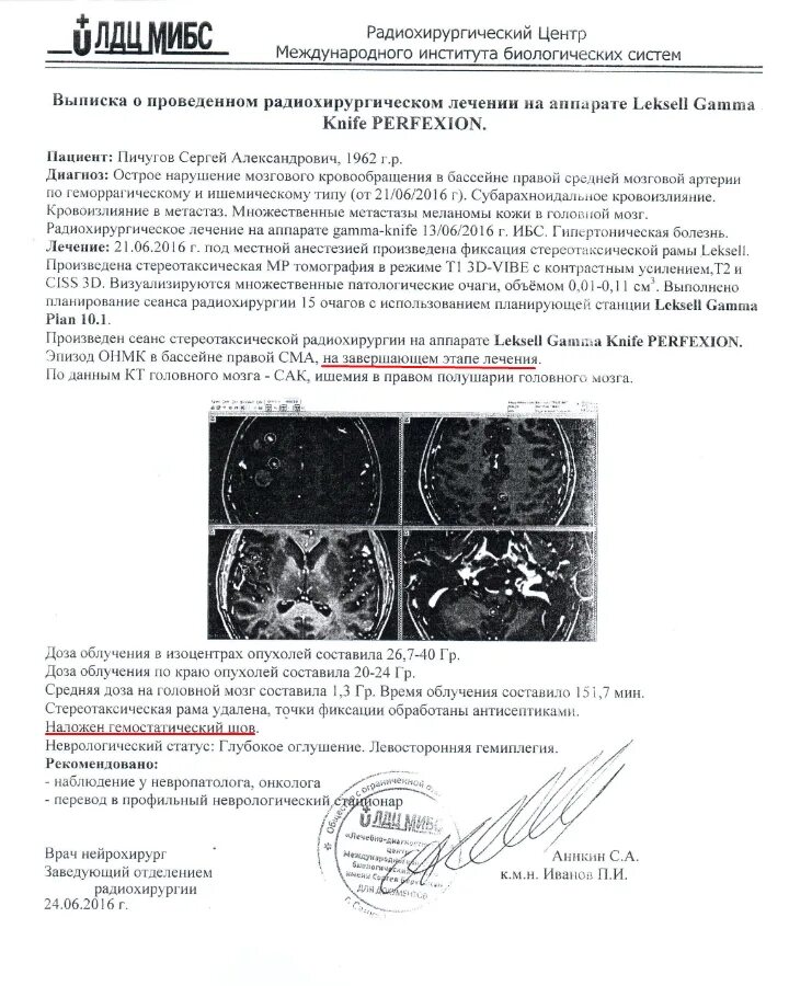 Рак мозга анализы крови. Опухоль головного мозга справка. Спарка о опухоли головного мозга. Справка о опухоли мозга. Справка об онкологии головного мозга.