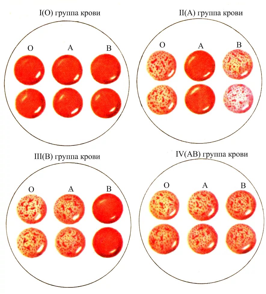 Белки определяющие группу крови. Как определить группу крови 1 положительная. Группа крови 2 отрицательная как определить. 2 Группа и 1 группа крови.