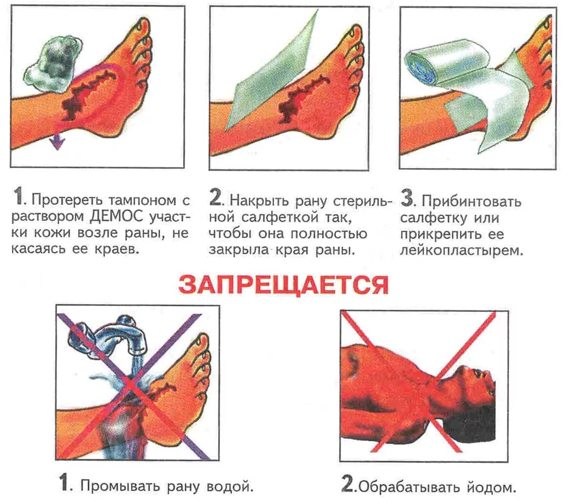 Сильная рана что делать