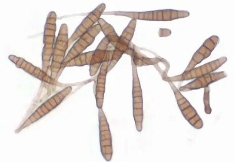 Alternaria alternata