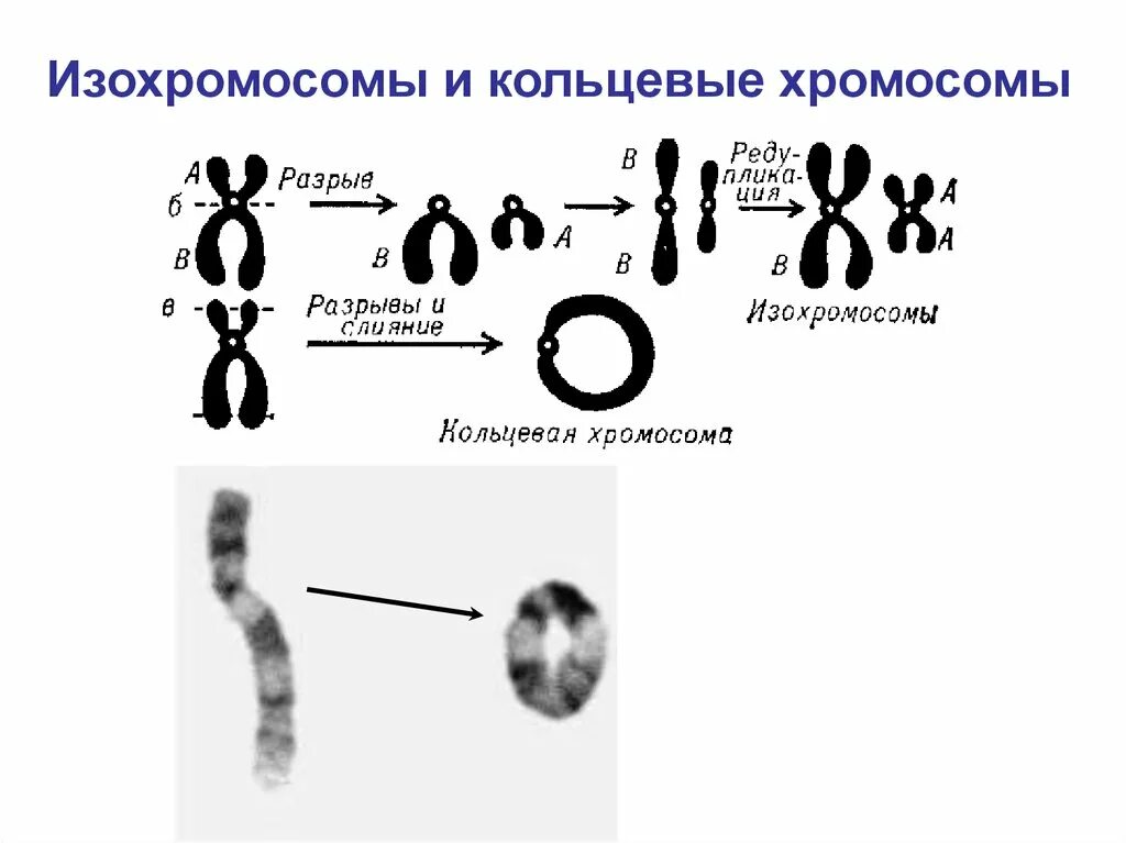 Кольцевая хромосома в кариотипе. Дицентрическая хромосома. Хромосомные болезни кольцевые хромосомы. Ана-телофазного метода анализа хромосомных аберраций. Изменение формы хромосом