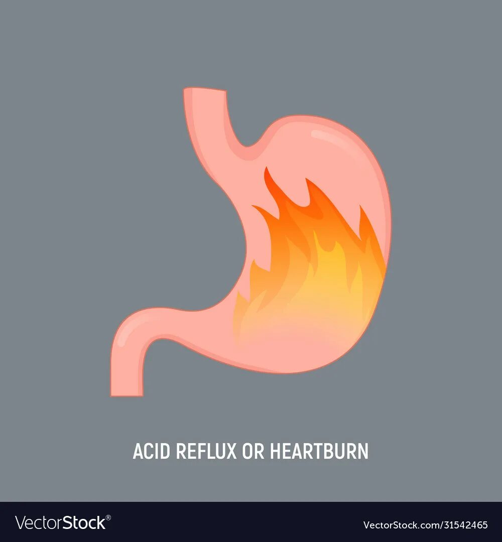 Почему горит желудок. Изжога иконка. Изжога рисунок. ЖКТ иконка.