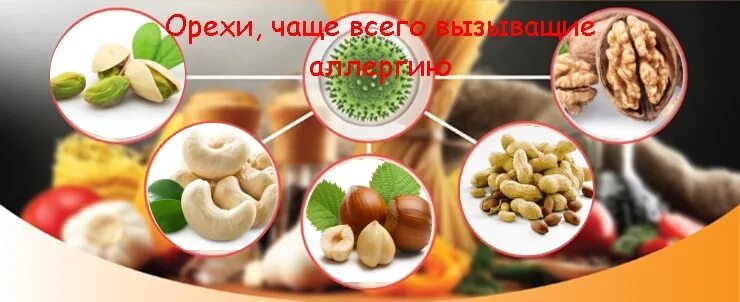 Миндаль аллерген. Орехи вызывающие аллергию. самые аллергенные орехи. перекрестные аллергены грецкий орех. перекрестный аллерген фундука.