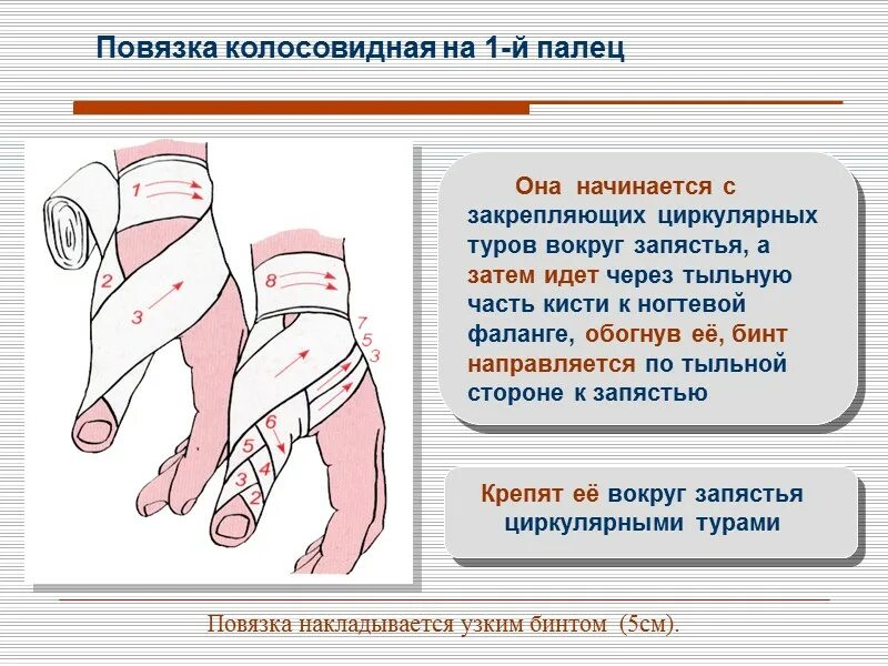 Наложение колосовидной повязки на 1 палец кисти. Колосовидная повязка на кисть. Наложение колосовидной повязки на 1 палец кисти. Колосовидная повязка на палец кисти. Колосовидная повязка на 1 палец кисти.