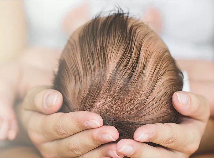 Родничок рождения. Родничок у новорожденных. Впалый Родничок у грудничка.