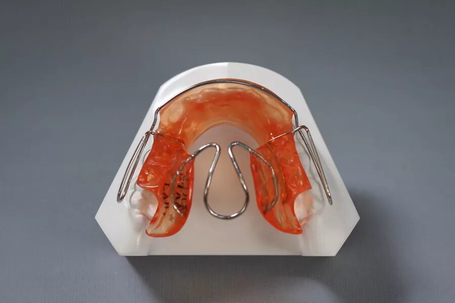 центр лингвальной ортодонтии киренского. центр лингвальной ортодонтии киренского. центр лингвальной ортодонтии киренского. брекеты 2d forestadent (германия). вестибулярные и лингвальные брекеты.