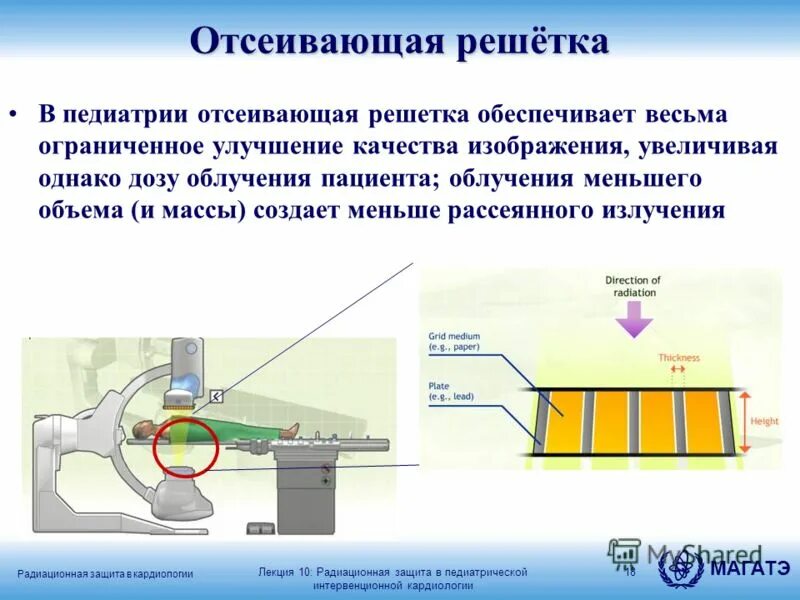отсеивающая решетка к рентген аппарату. решетка рентгеновская отсеивающая. решетка рентгеновская отсеивающая. растр рентгеновский отсеивающий. преобразователь рентгеновского изображения.