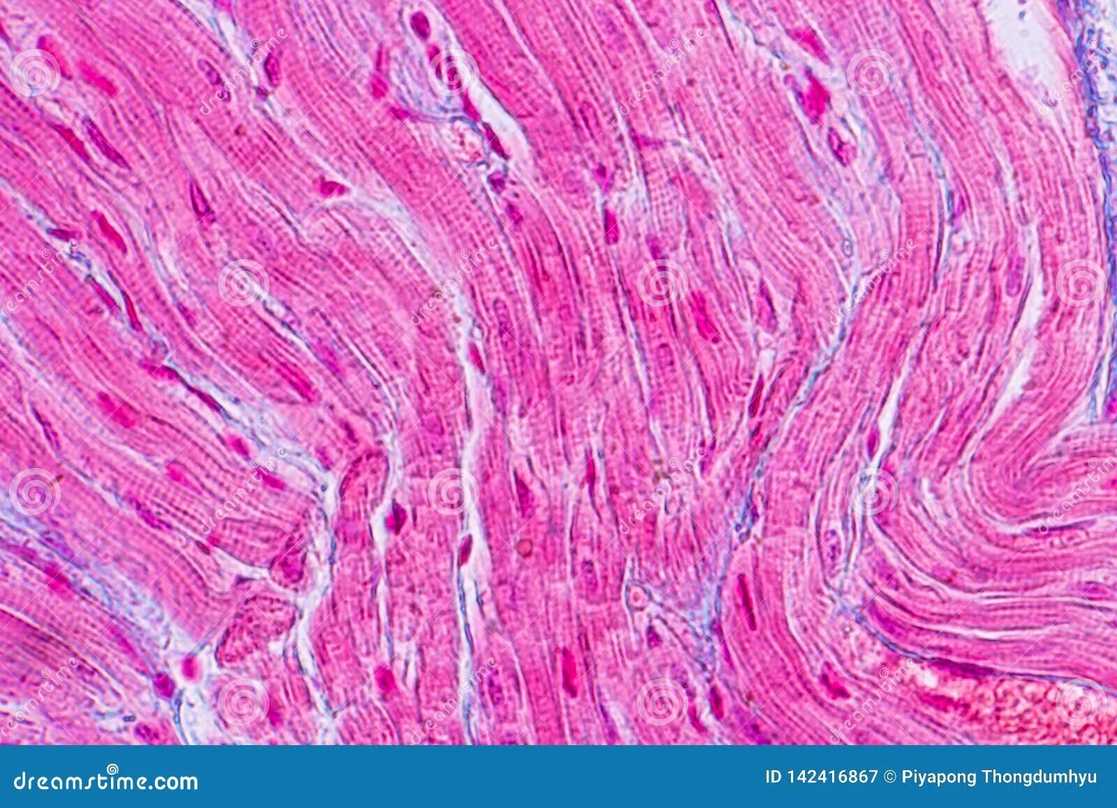 Сердечная ткань миокарда. Миокард под микроскопом гистология. мышечная ткань микроскоп. поперечно полосатые мышцы под микроскопом. сердечная ткань под микроскопом.