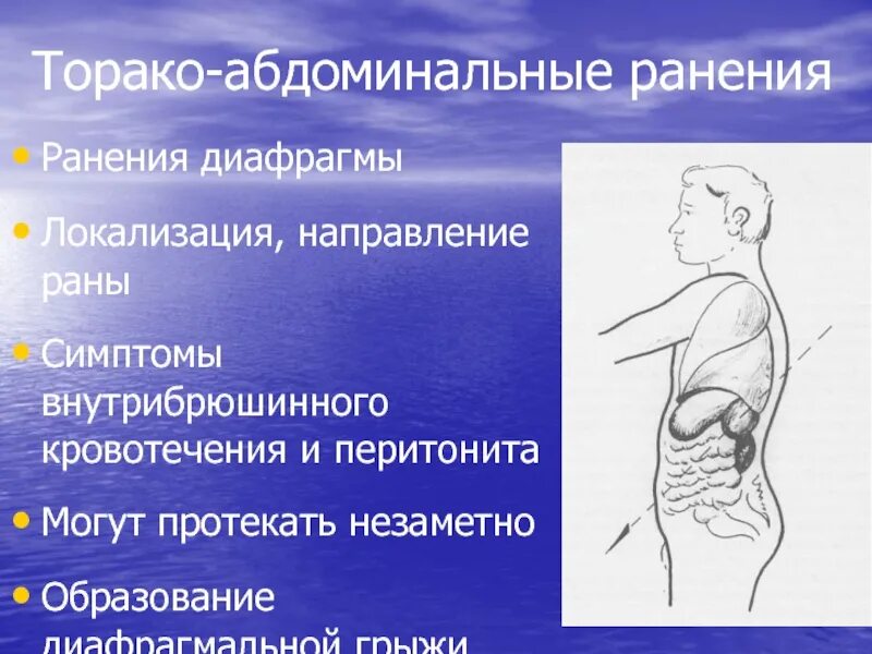Торакоабдоминальные ранения диагностика. Торакоабдоминальные ранения. Торако абдоминальный. Патогенез плевропульмонального шока. Торакоабдоминальное ранение понятие.