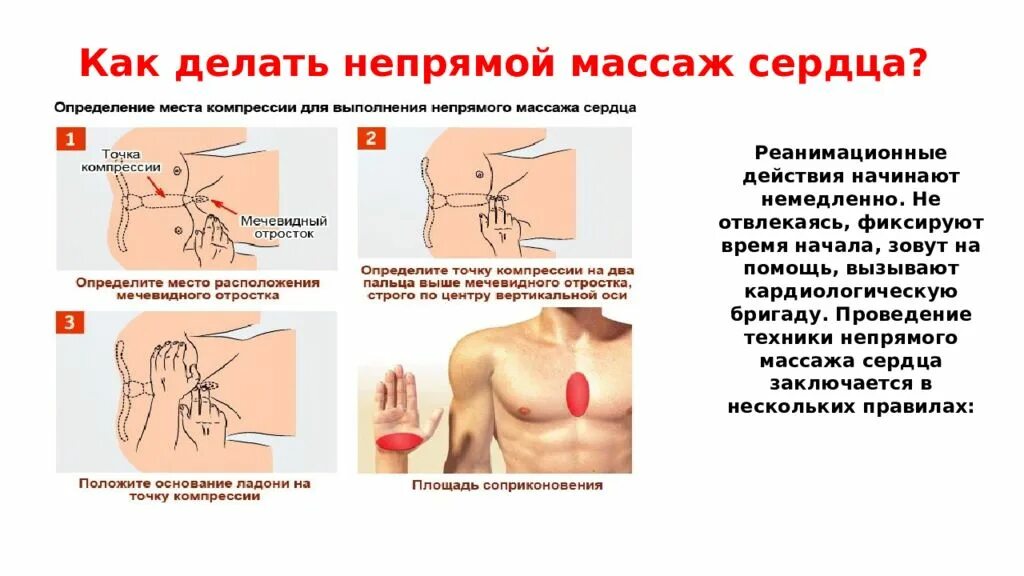 Непрямой массаж сердца техника выполнения. Точка приложения рук при проведении непрямого массажа сердца. Методика непрямого массажа сердца. Методика выполнения наружного массажа сердца. Как проводится непрямой массаж сердца