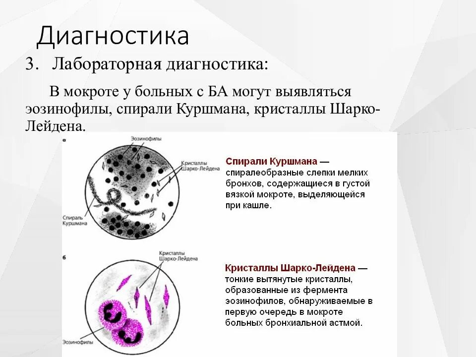 Куршмана кристаллы шарко лейдена. Спирали Куршмана, Кристаллы Шарко-Лейдена, эозинофилы. Спирали Куршмана и Кристаллы Шарко-Лейдена в мокроте определяются. Спирали Куршмана и Кристаллы Шарко-Лейдена в мокроте. Кристаллы Шарко Лейдена.